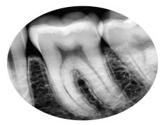 X-Ray, Examination, Health, Screening, Imaging PNG